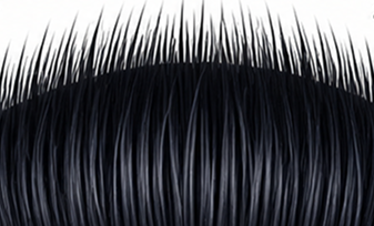 Artificial hairline — too straight, pluggy