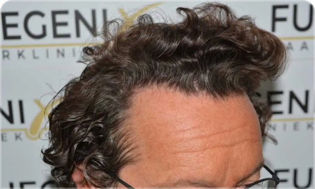 Complete Discretion