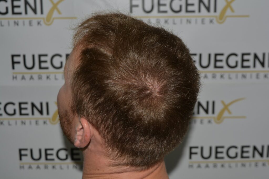 Next Level Crown Comb Through