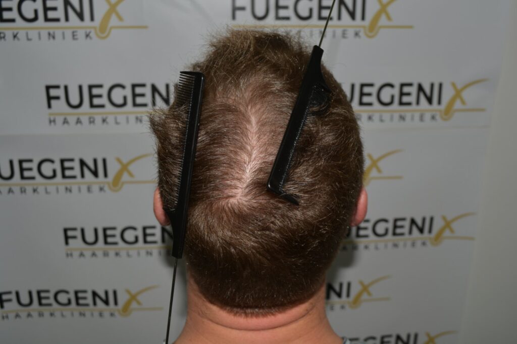 Next Level Crown Comb Through