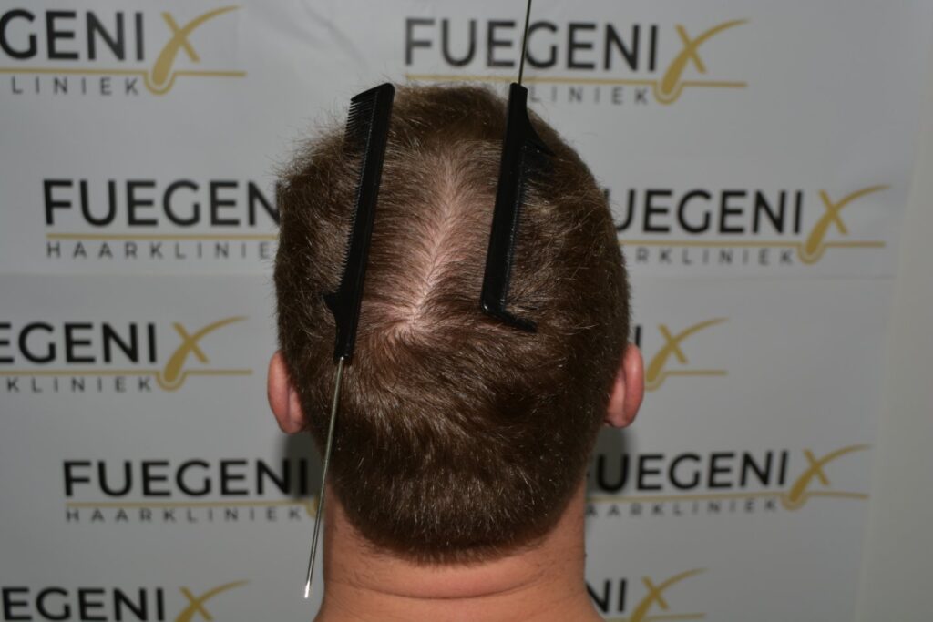 Next Level Crown Comb Through