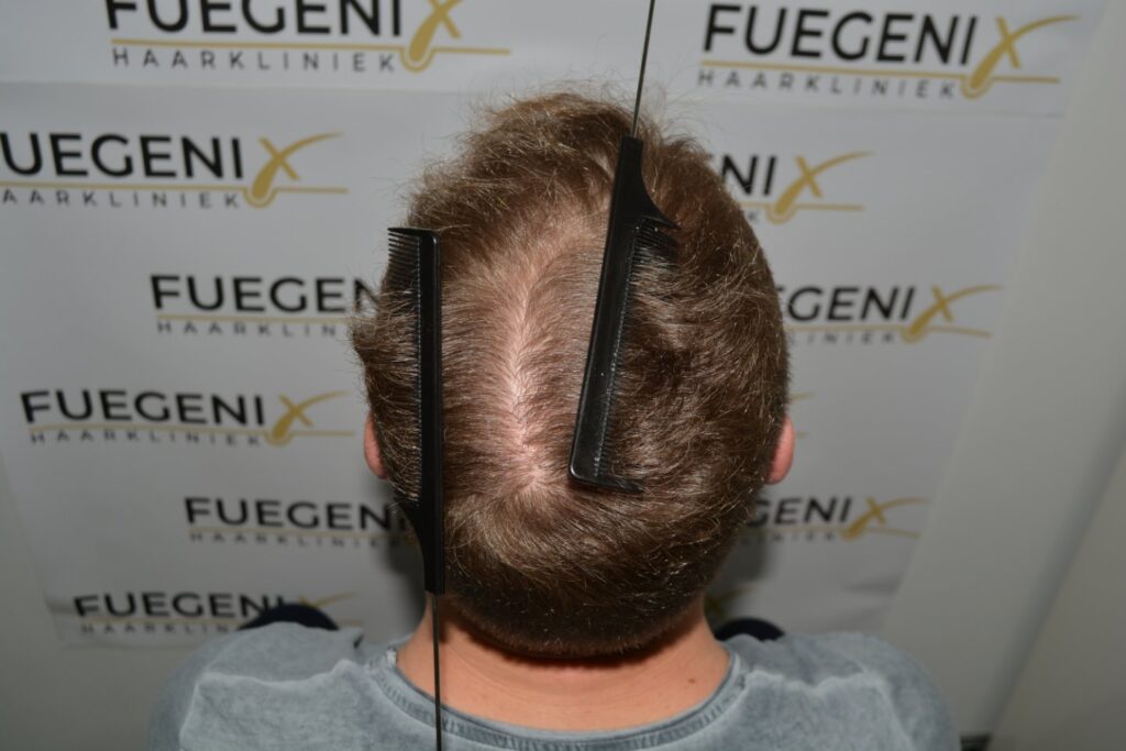 Next Level Crown Comb Through