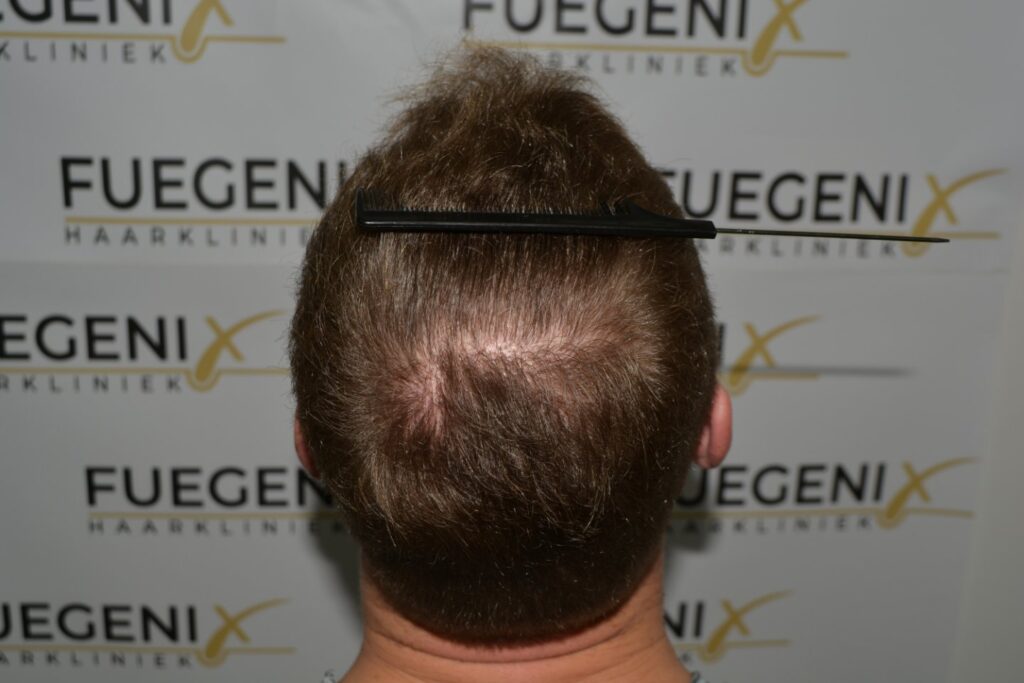 Next Level Crown Comb Through