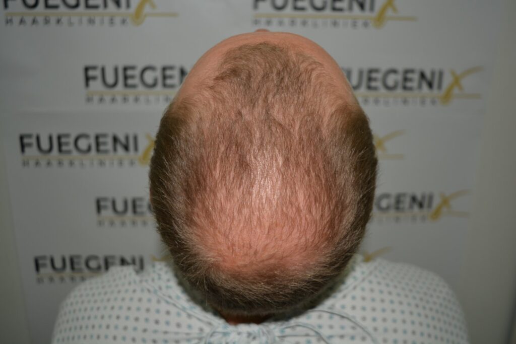 Next Level Crown Comb Through