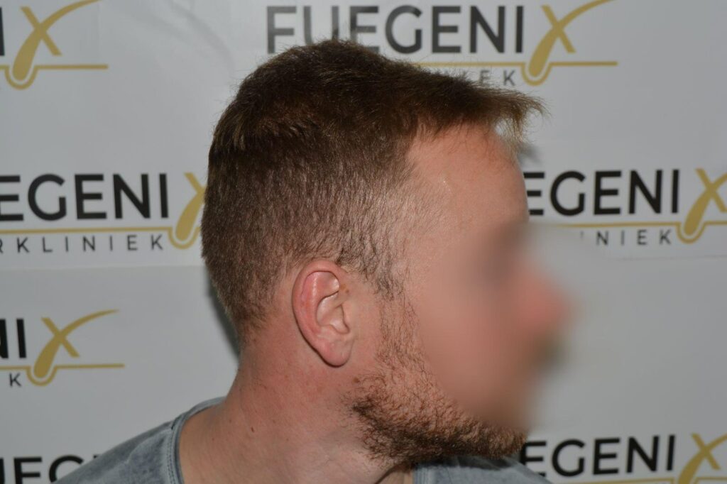 Next Level Crown Comb Through