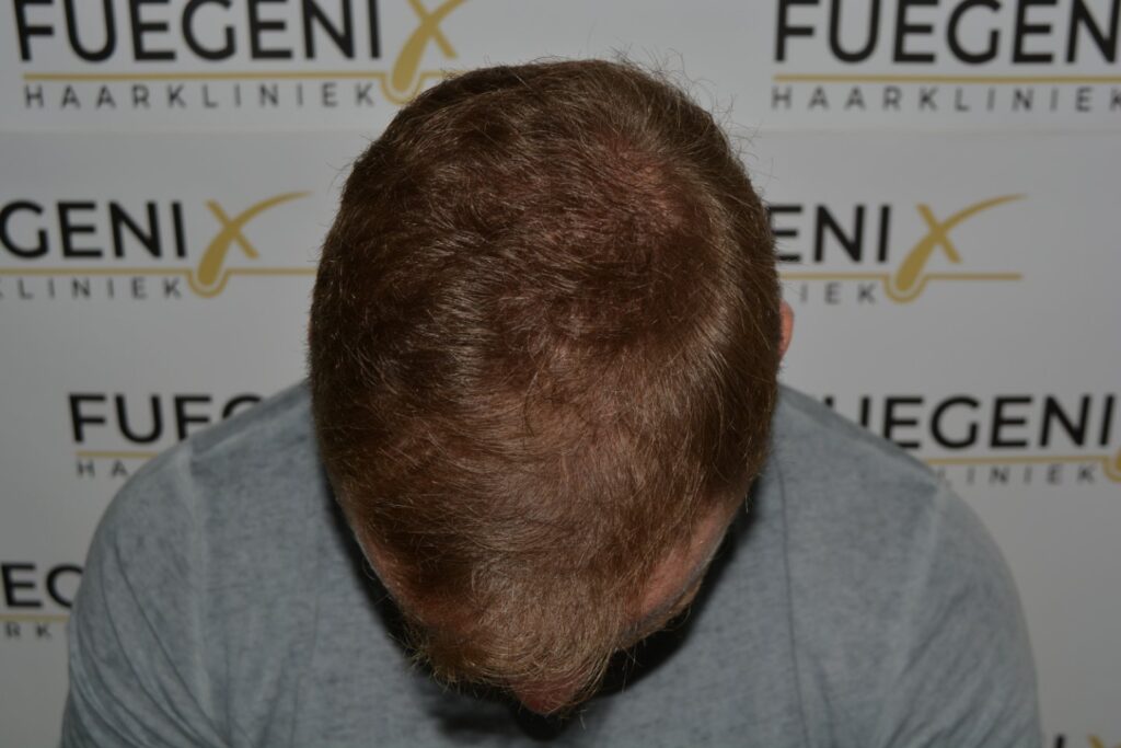 Next Level Crown Comb Through