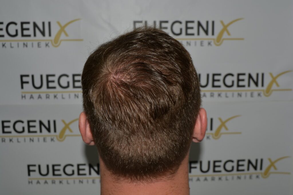 Next Level Crown Comb Through