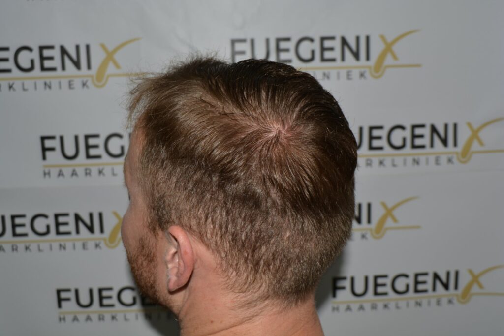 Next Level Crown Comb Through
