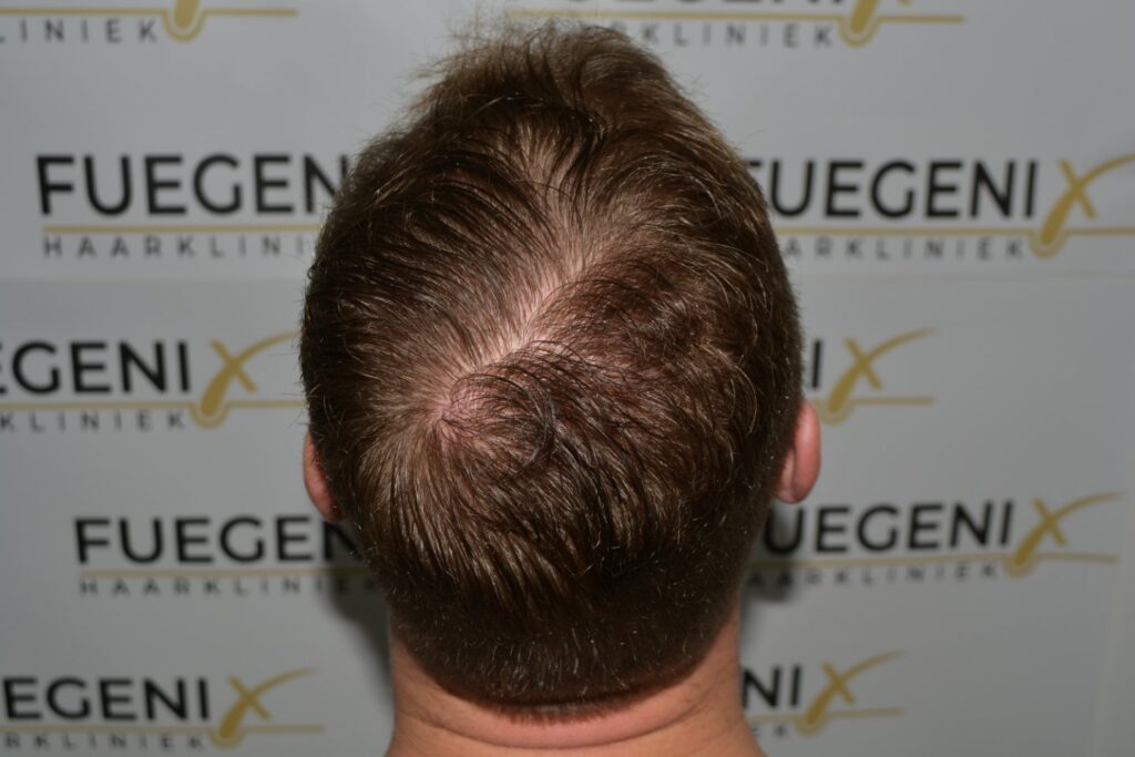 Next Level Crown Comb Through