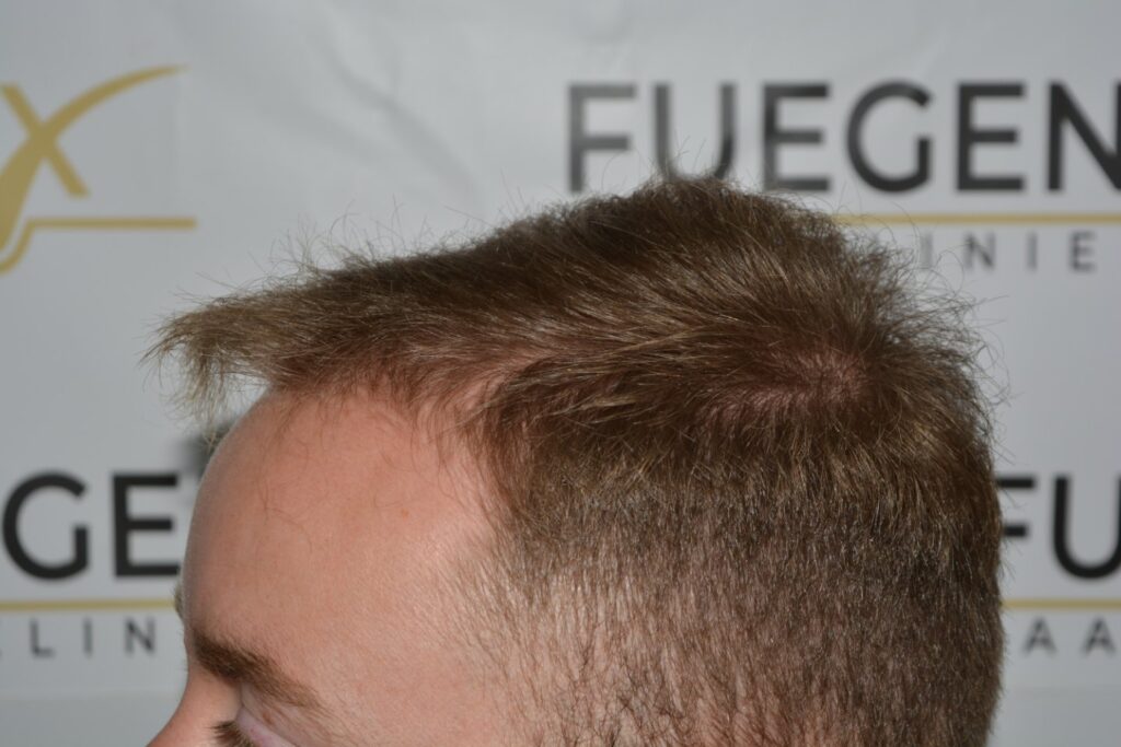 Next Level Crown Comb Through