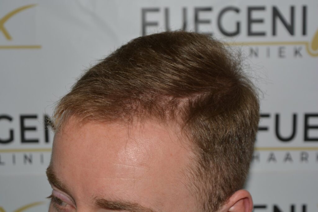 Next Level Crown Comb Through