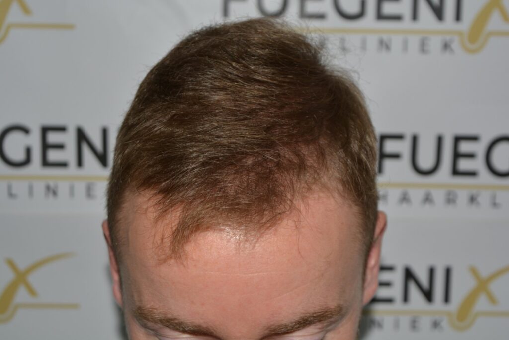 Next Level Crown Comb Through