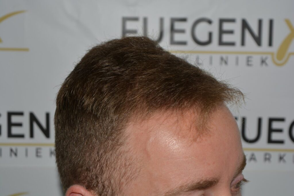 Next Level Crown Comb Through