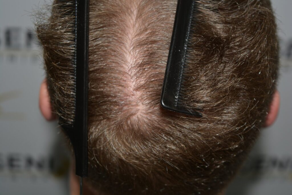 Next Level Crown Comb Through