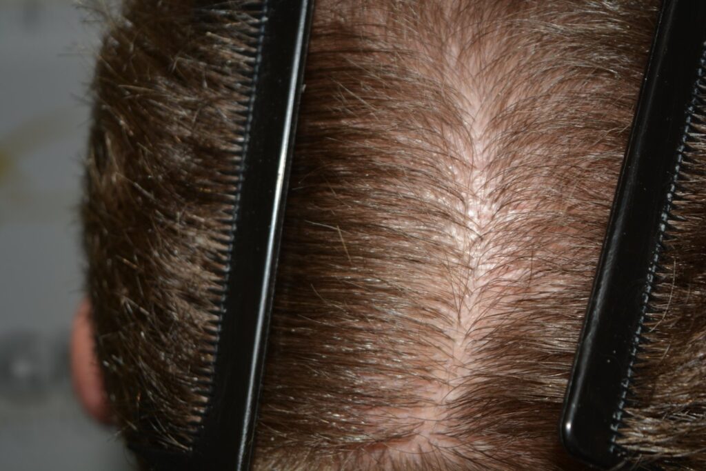 Next Level Crown Comb Through