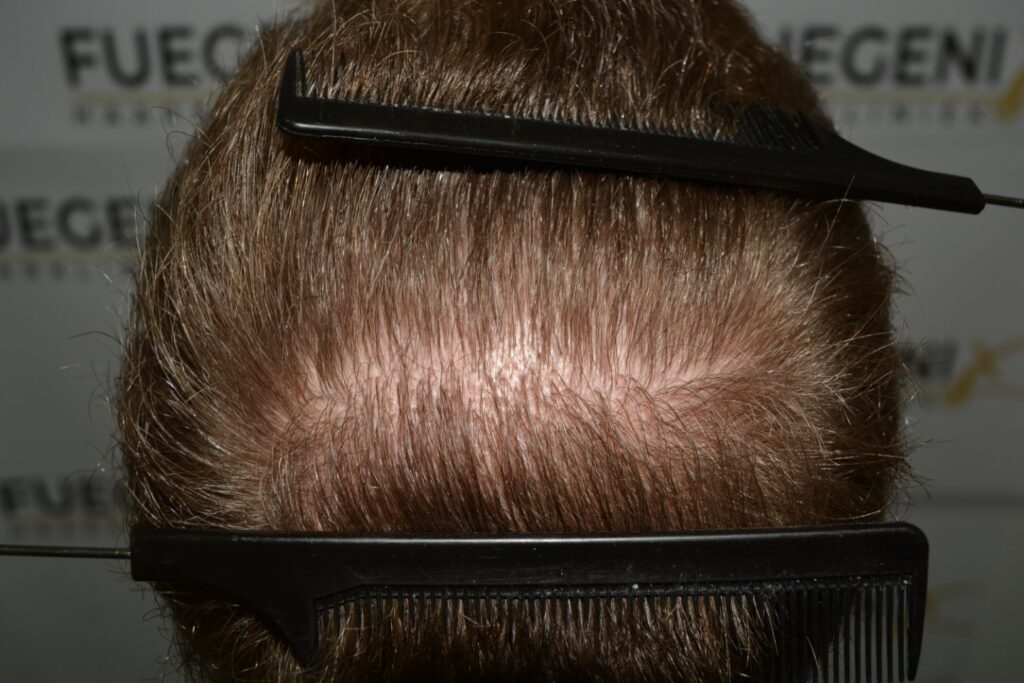 Next Level Crown Comb Through