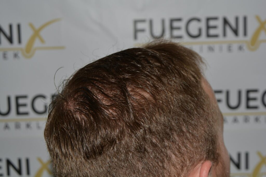 Next Level Crown Comb Through