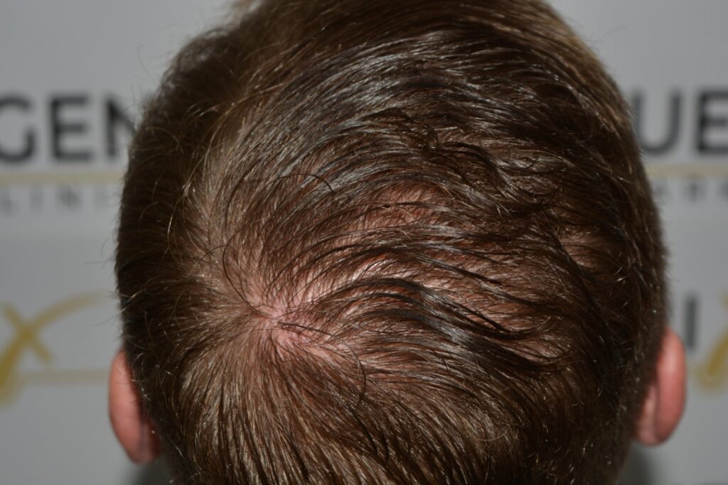 Next Level Crown Comb Through