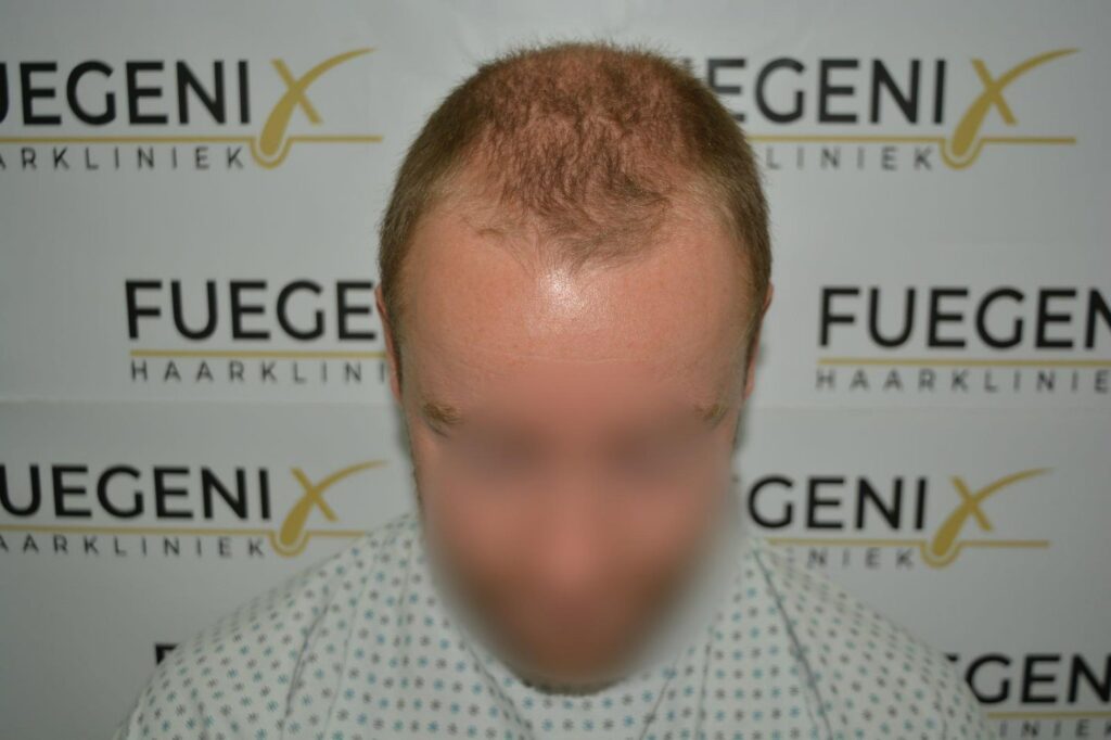 Next Level Crown Comb Through