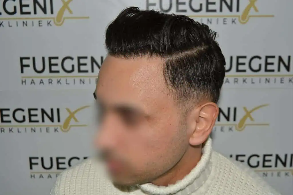 The Bollywood Hairline