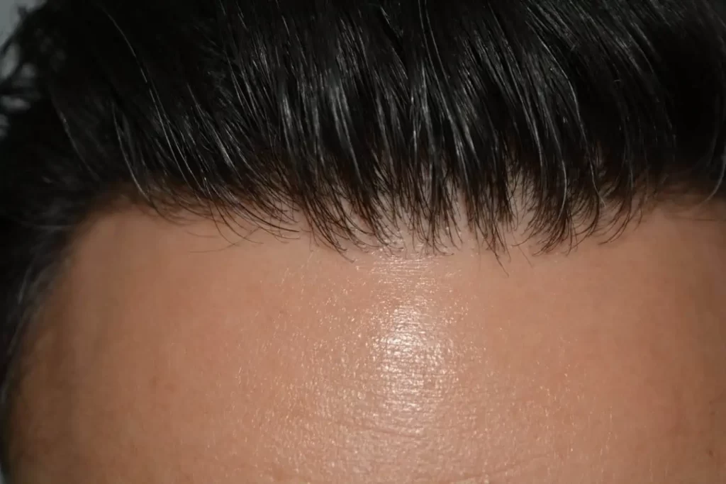 The Bollywood Hairline