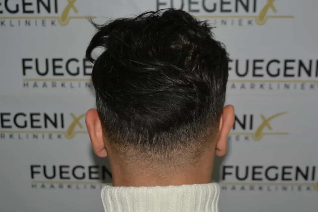 The Bollywood Hairline