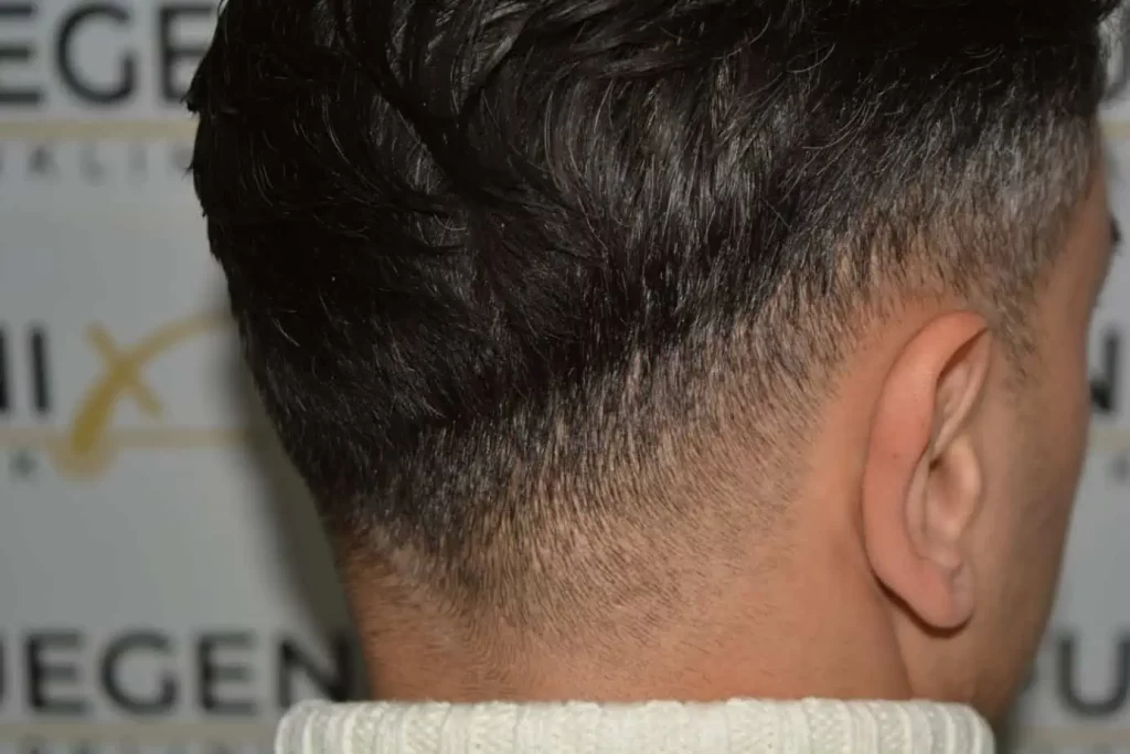 The Bollywood Hairline