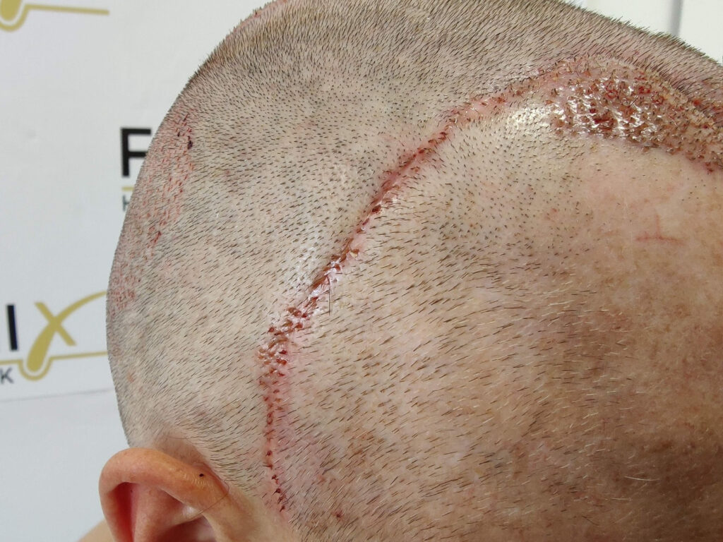 Scars All In One